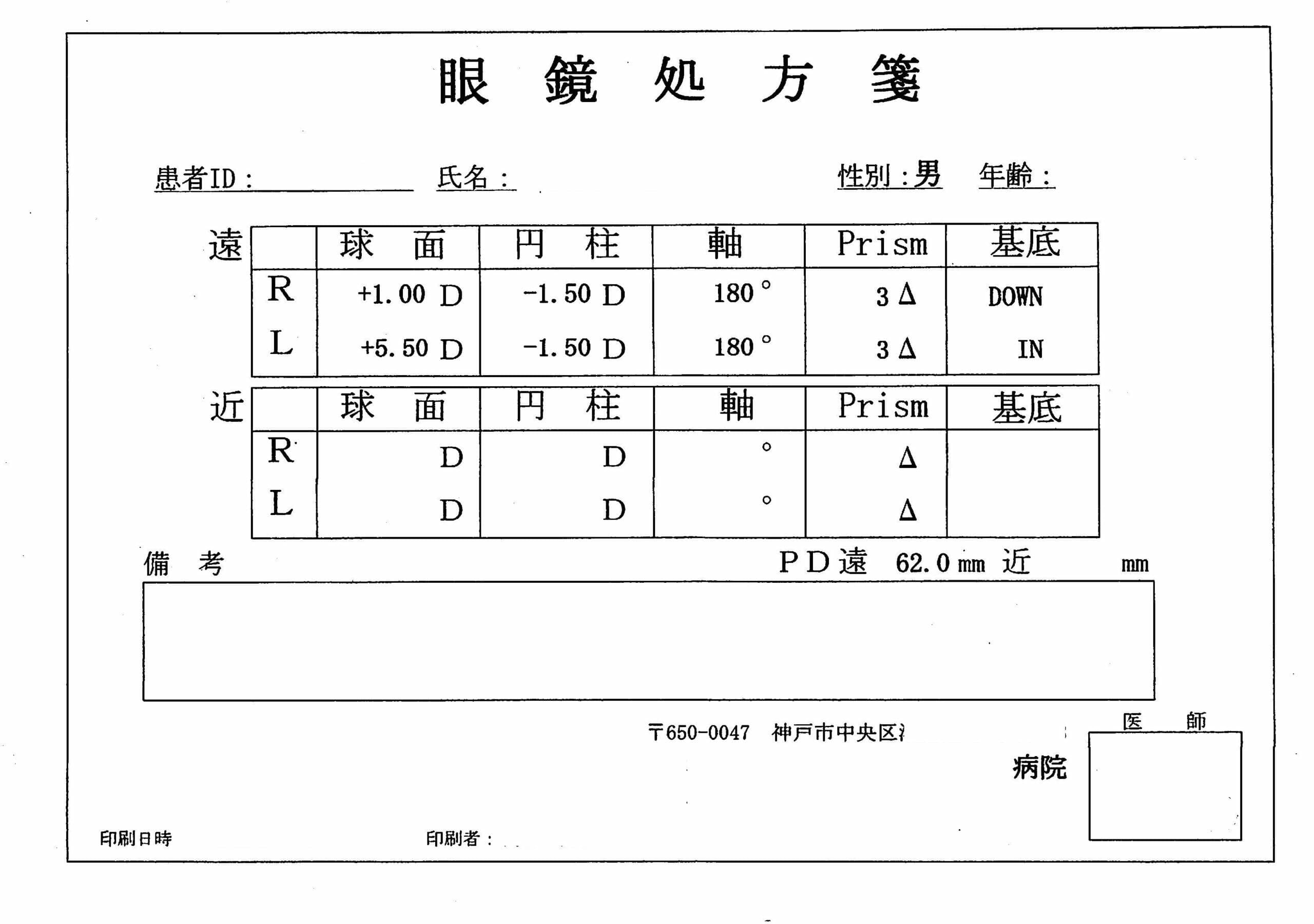 視力検査について