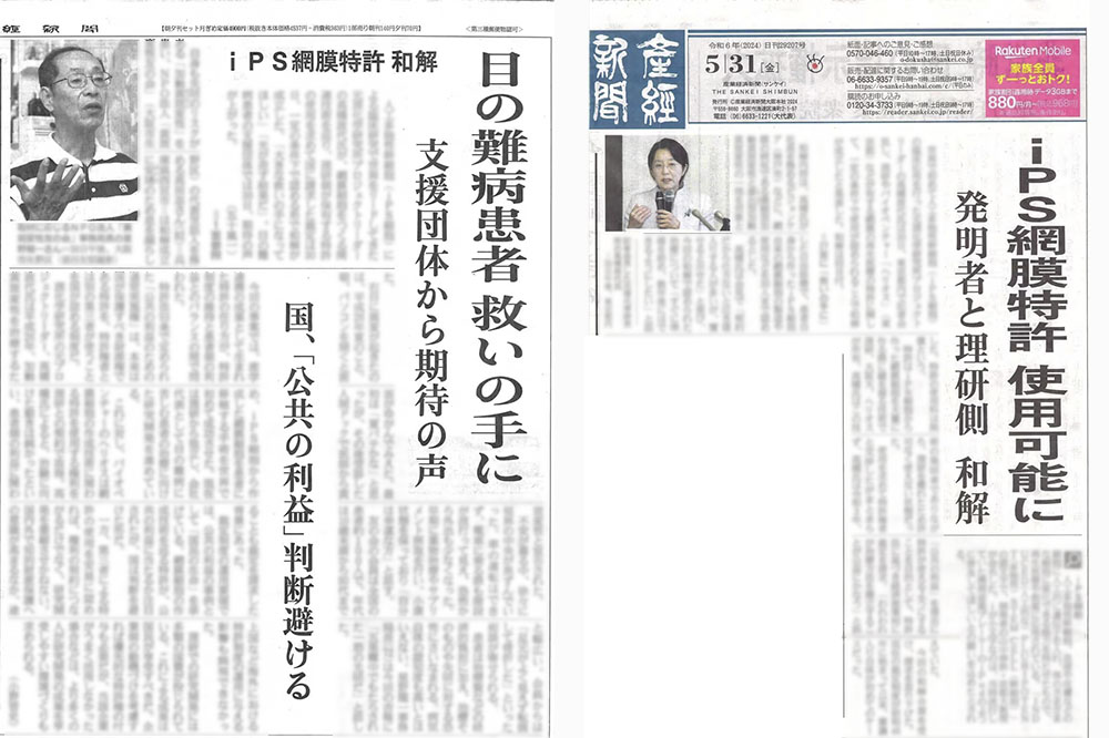 産経新聞記事「iPS網膜特許 使用可能に」